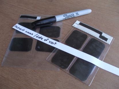 Two sets of X-ray films, Sharpie pen, hand-written label.