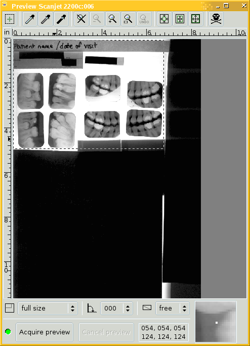 Preview scan of 8 dental intraoral X-ray films, gamma adjusted by +1.