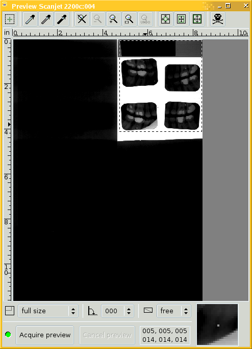 XSane software scanning bite-wing dental X-ray film.