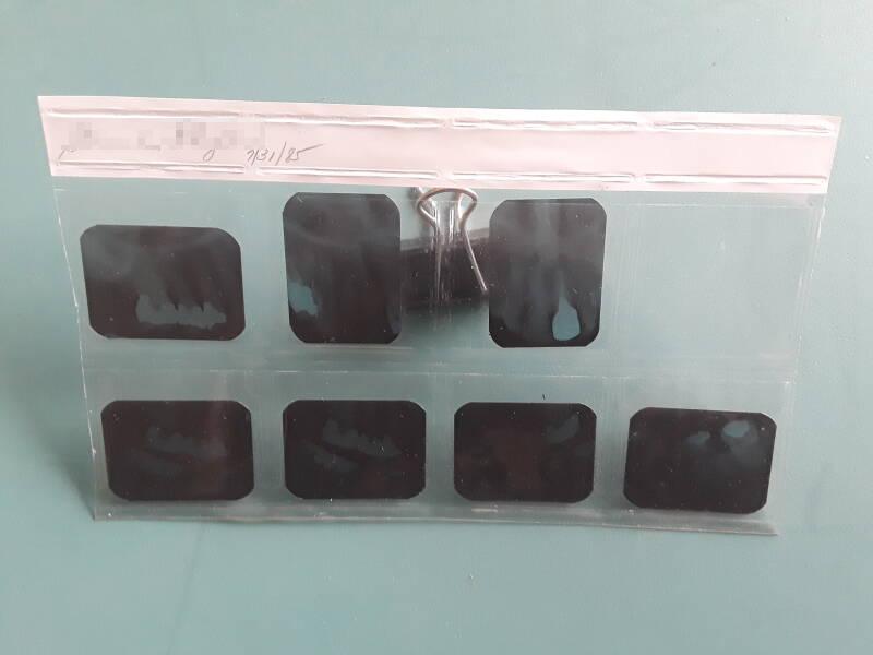 Seven bitewing xray films in a plastic sleeve.